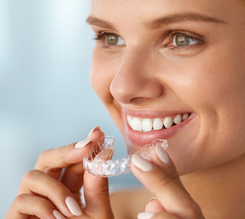 invisalign in langley