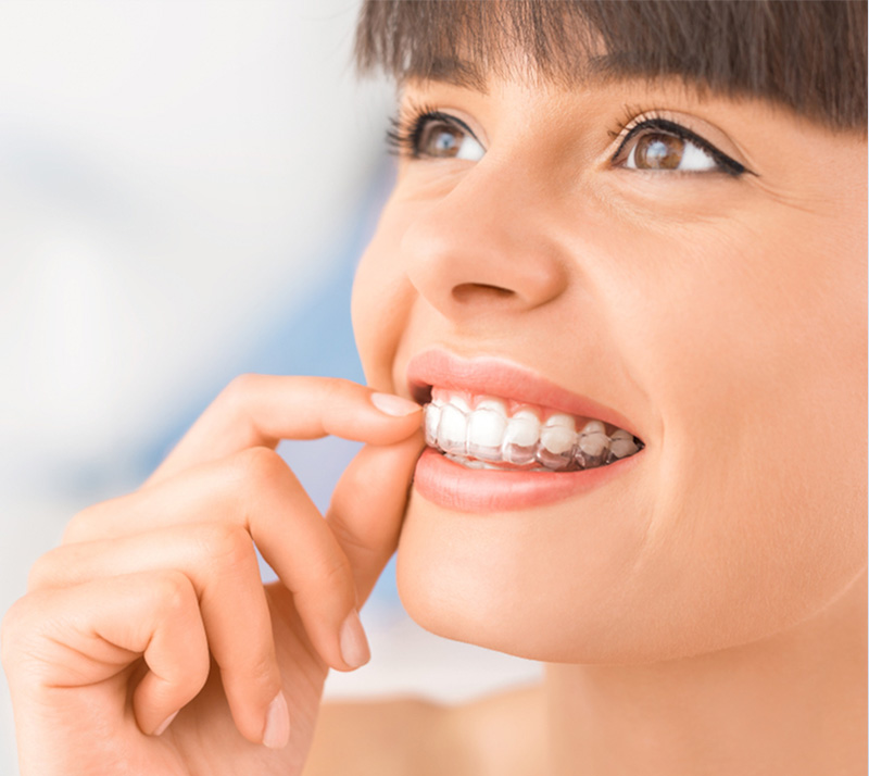 orthodontics in langley