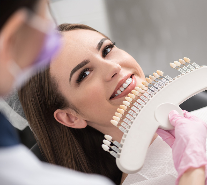 procelain veneers in langley