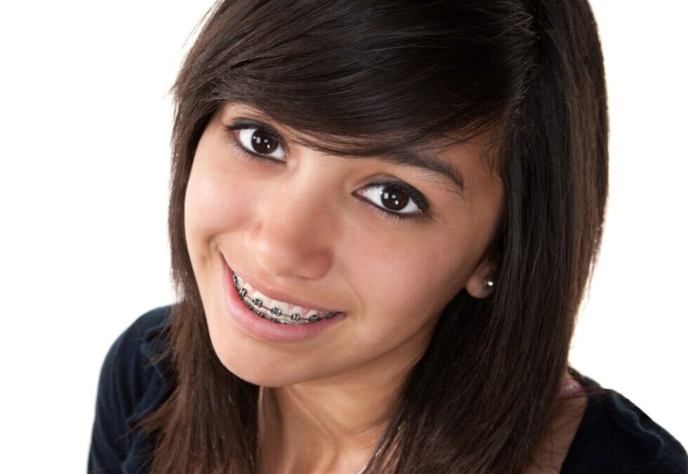 Girl smiling after orthodontics treatment in langley